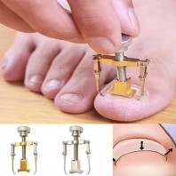 Ingrown Toe Nail Care Tool Professional File Corrector Device Pedicure Foot Orthotic Acronyx Onyxis bunion Protector